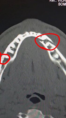 17662378361353063006550951769836