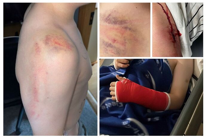Some of the injuries suffered by the 12-year-old boy